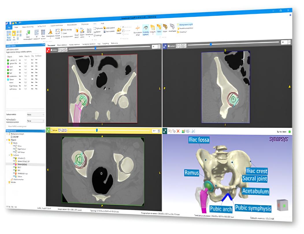 3D 醫學影像處理解決方案