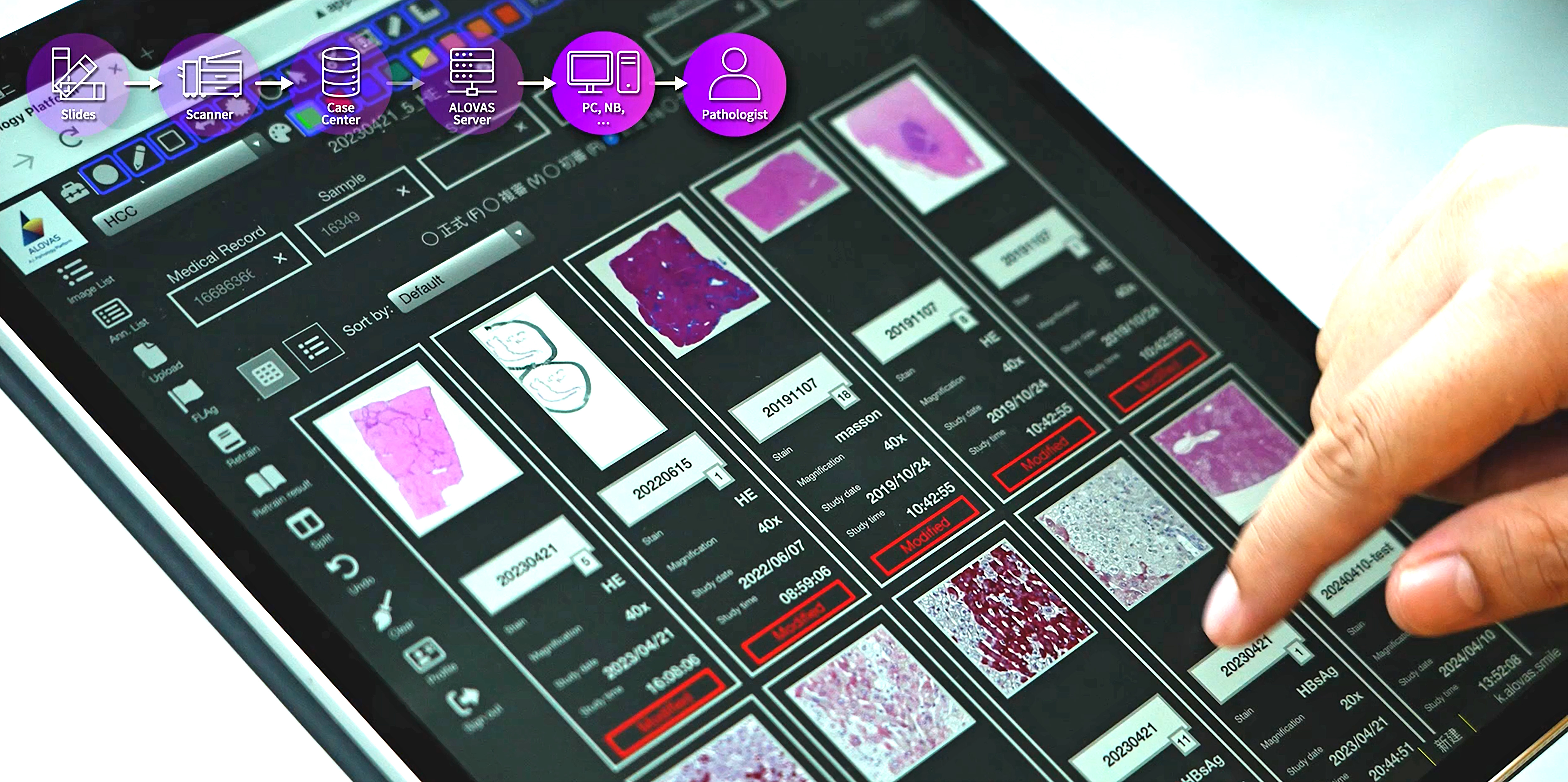 ALOVAS系統設計有多種實用功能和清晰易懂的介面