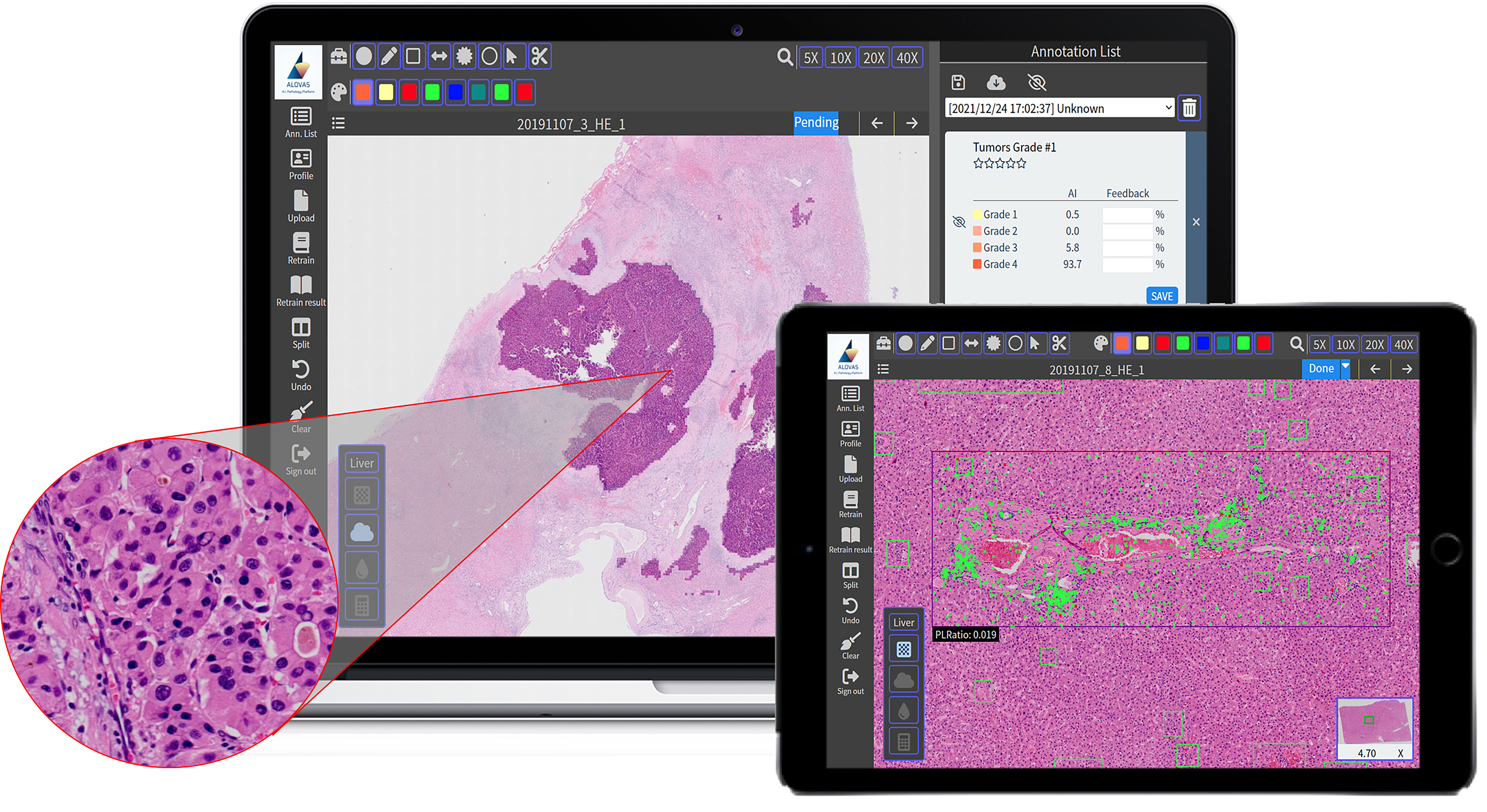 ALOVAS系統能在不同種類的裝置上運行