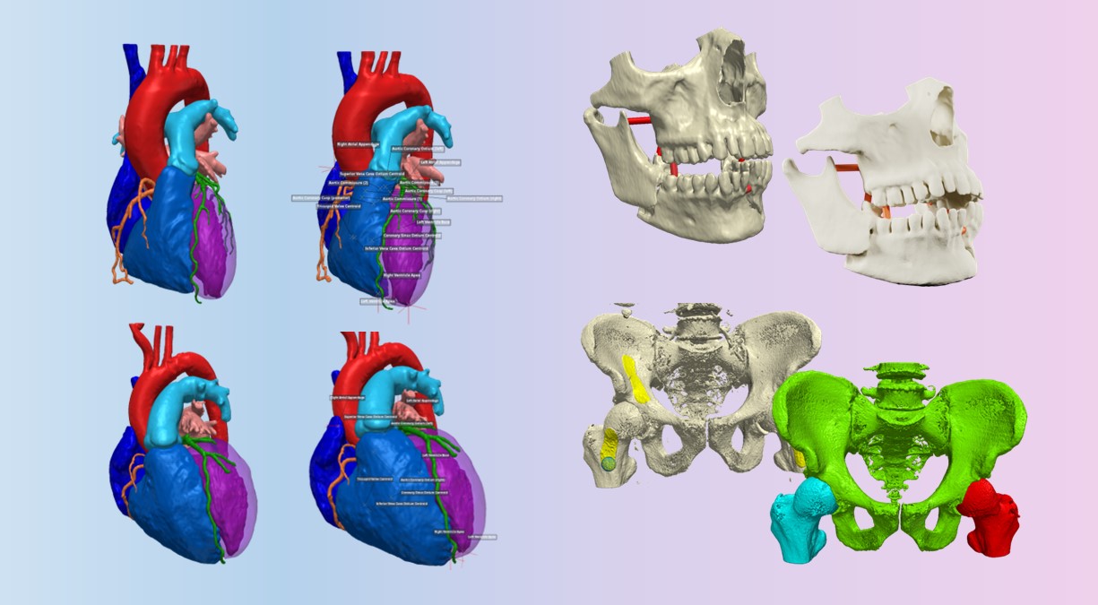 人體 3D 模型解決方案