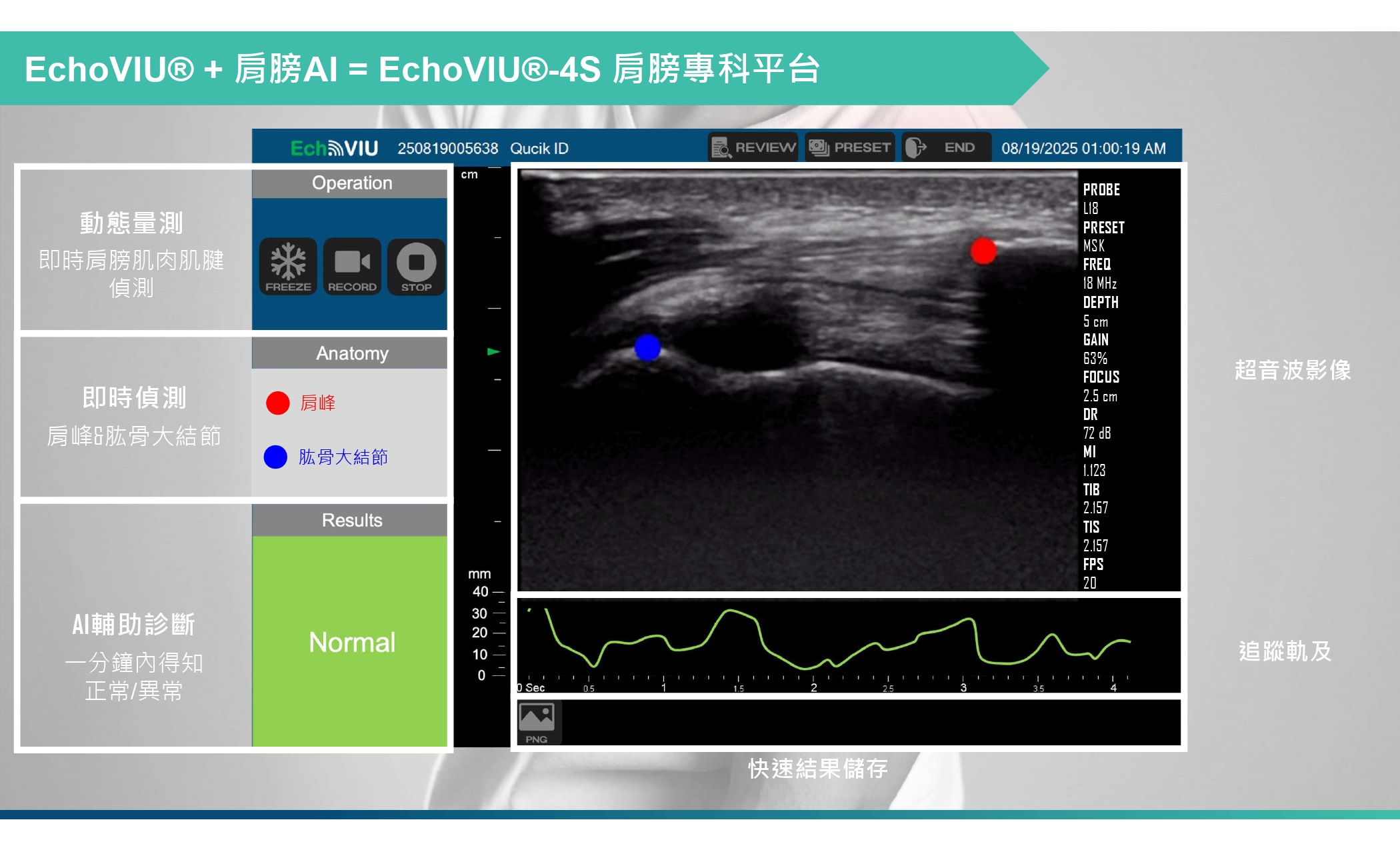 EchoVIU® + 肩膀AI = EchoVIU®-4S 肩膀專科平台